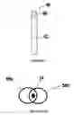 Fig. 07 - SPINAL CORD STIMULATION SYSTEM