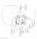 Fig. 03 - Devices and methods for sleep apnea treatment