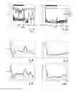 Fig. 06 - Device and method for effective non-invasive neurostimulation by means of varying stimulus sequences