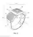 Fig. 03 - Measuring the “on-skin” time of a transcutaneous electrical nerve stimulator (TENS) device in order to minimize skin irritation due to excessive uninterrupted wearing of the same