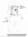 Fig. 01 - WEARABLE CARDIOVERTER DEFIBRILLATOR COMPONENTS DISCARDING ECG SIGNALS PRIOR TO MAKING SHOCK/NO SHOCK DETERMINATION BASED ON CORRELATION