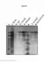 Fig. 04 - Compounds for affinity chromatography and for extending the half-life of a therapeutic agent