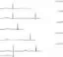 Fig. 64 - Resist composition and method for forming resist pattern