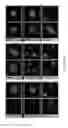 Fig. 35 - METHODS FOR INCREASING CELL CULTURE TRANSFECTION EFFICIENCY AND CELLULAR REPROGRAMMING