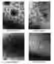 Fig. 01 - Method for identifying pathogens of bacterial infectious diseases by using bacteria-derived nanovesicles