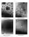 Fig. 02 - Method for identifying pathogens of bacterial infectious diseases by using bacteria-derived nanovesicles