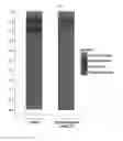 Fig. 08 - Method for identifying pathogens of bacterial infectious diseases by using bacteria-derived nanovesicles