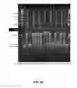 Fig. 09 - MICROARRAY SYSTEM WITH IMPROVED SEQUENCE SPECIFICITY
