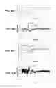 Fig. 07 - Firing fraction transition control