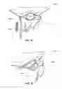 Fig. 08 - Valve for inflation/deflation