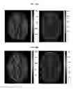 Fig. 08 - Graphical processing unit (GPU) implementation of magnetic resonance fingerprinting (MRF)
