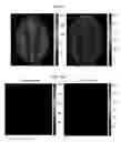 Fig. 09 - Graphical processing unit (GPU) implementation of magnetic resonance fingerprinting (MRF)