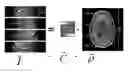 Fig. 01 - GPU based implementation of SENSE (a parallel MRI algorithm) using QR decomposition