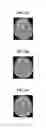 Fig. 05 - GPU based implementation of SENSE (a parallel MRI algorithm) using QR decomposition