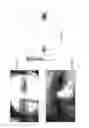 Fig. 03 - Image processing method and system for iris recognition