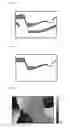 Fig. 05 - TOMOGRAPHIC IMAGING APPARATUS, TOMOGRAPHIC IMAGING METHOD, IMAGE PROCESSING APPARATUS, IMAGE PROCESSING METHOD, AND PROGRAM