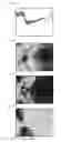 Fig. 10 - TOMOGRAPHIC IMAGING APPARATUS, TOMOGRAPHIC IMAGING METHOD, IMAGE PROCESSING APPARATUS, IMAGE PROCESSING METHOD, AND PROGRAM