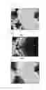 Fig. 11 - TOMOGRAPHIC IMAGING APPARATUS, TOMOGRAPHIC IMAGING METHOD, IMAGE PROCESSING APPARATUS, IMAGE PROCESSING METHOD, AND PROGRAM