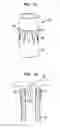 Fig. 09 - PMVR clip configurations for mitral leaflet