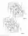 Fig. 02 - VERTEBRAL SCAFFOLD FOR SUPPORTING A REAR OF A SPINAL COLUMN ALONG OPPOSITE EXTENDING ROWS OF LATERAL PROCESSES