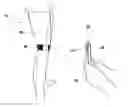 Fig. 01 - Measurement and ordering system for orthotic devices