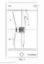 Fig. 09 - Measurement and ordering system for orthotic devices