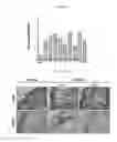 Fig. 04 - Methods for inducing an immune response via buccal and/or sublingual administration of a vaccine
