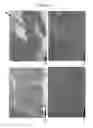 Fig. 02 - INJECTABLE AGGREGATES FOR JOINT AND SOFT TISSUE DISTRESS