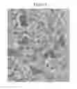 Fig. 03 - INJECTABLE AGGREGATES FOR JOINT AND SOFT TISSUE DISTRESS