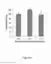 Fig. 07 - CRUCIFERIN COATED NANOPARTICLES