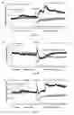 Fig. 12 - Compositions and methods for stimulating ventilatory and/or respiratory drive