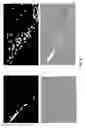 Fig. 06 - Medicinal composition for treating urinary tract infection (UTI)