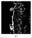 Fig. 07 - Medicinal composition for treating urinary tract infection (UTI)