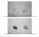 Fig. 02 - Methods of treating a treatment-resistant gastrointestinal spasm