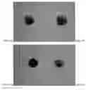 Fig. 03 - Methods of treating a treatment-resistant gastrointestinal spasm