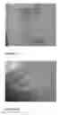 Fig. 03 - One component fibrin glue comprising a polymerization inhibitor
