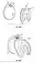 Fig. 42 - Breast pump assembly