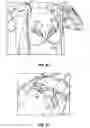 Fig. 50 - Breast pump assembly
