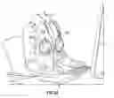Fig. 52 - Breast pump assembly