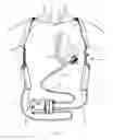 Fig. 02 - Systems for upgrading ventricle assist devices