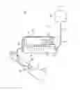 Fig. 01 - Infusion state detection system