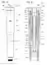 Fig. 13 - Injection device