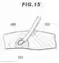 Fig. 11 - NEEDLE AND MANUFACTURING METHOD THEREOF