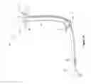 Fig. 02 - Tracheal protective neonatal ventilation device