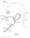 Fig. 10 - Cannula device for high flow therapy