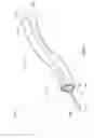 Fig. 04 - CATHETER SYSTEMS AND ENDOSCOPIC SYSTEMS WITH REDUCED BACKLASH