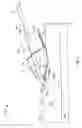 Fig. 02 - Systems and methods for anchoring medical devices