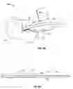 Fig. 06 - Systems and methods for anchoring medical devices