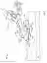 Fig. 08 - Systems and methods for anchoring medical devices