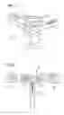 Fig. 05 - Introducer sheath
